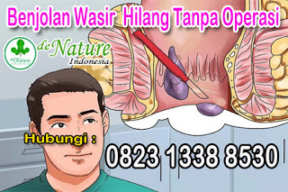 Illustration for article titled Nama Obat Ambeien Wasir Ampuh Di Apotik Umum Resep Saran Dokter
